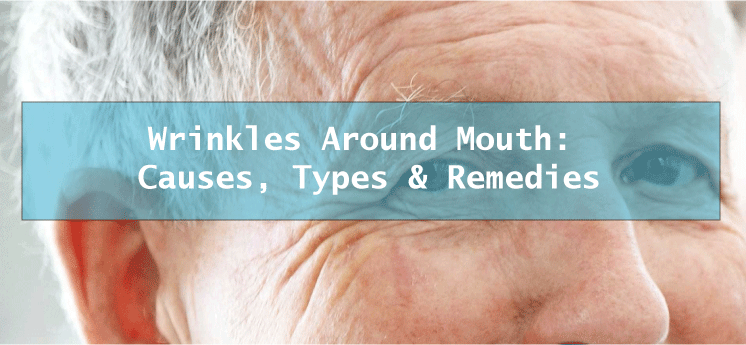 Wrinkles around mouth
