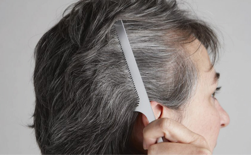 premature grey hair
