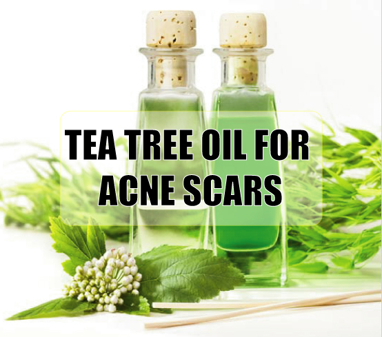 tea tree oil for acne scars