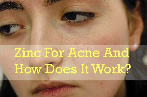 zinc for acne