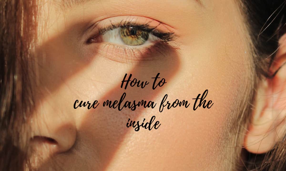 how to cure melasma from the inside